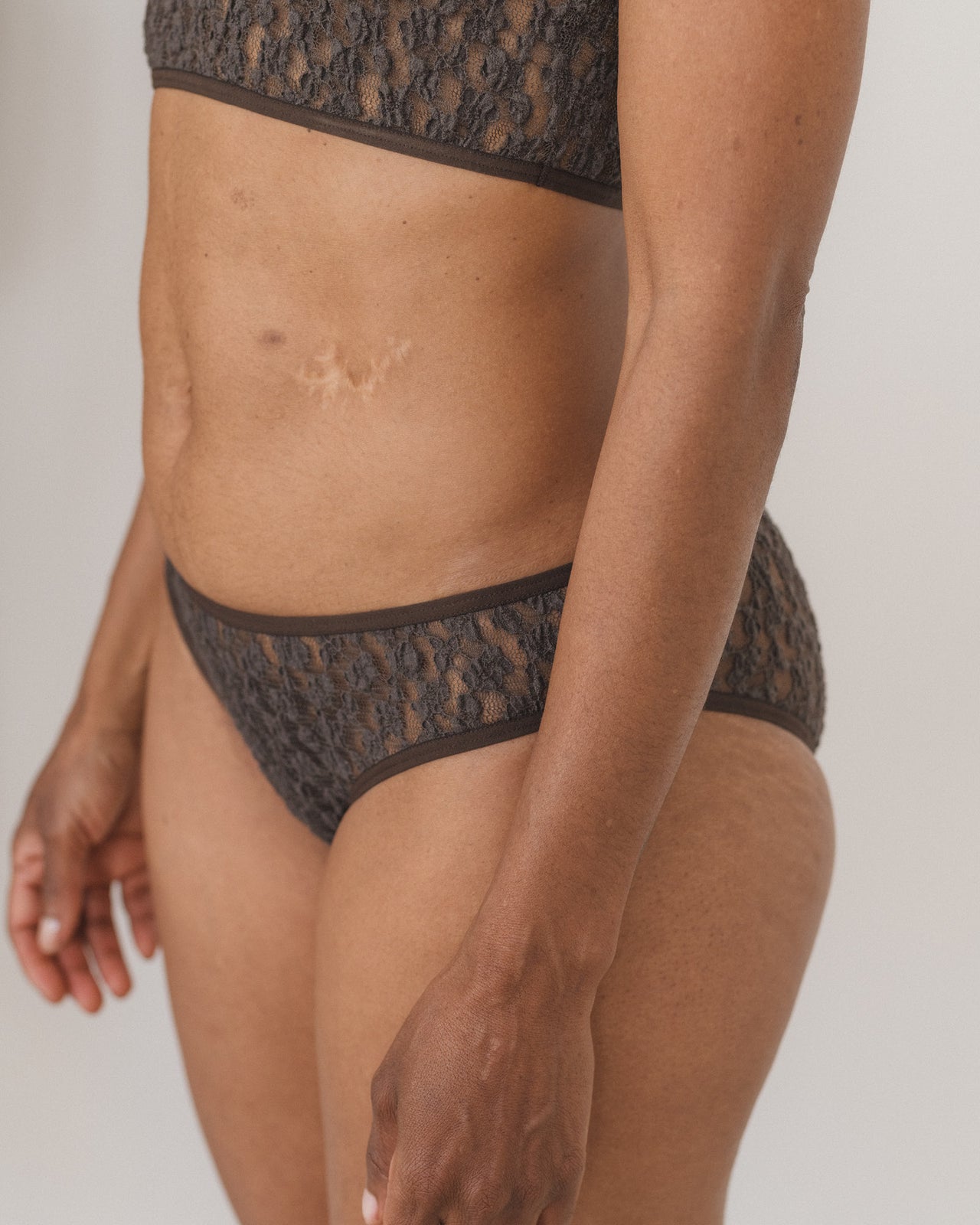 Musial Pants - Organic Cotton Lace - Black